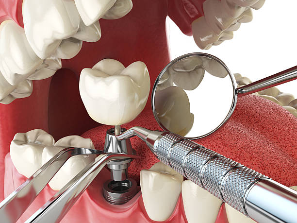 Best Broken or Cracked Tooth Emergency Dentist in Campbellsport, WI